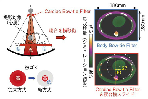 }5@Cardiac Bow-tie Filter & Q䉡XCh