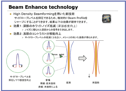 }9@Beam Enhance TechnologyiBoost ImagingjiŃfBJVXeY񋟁j