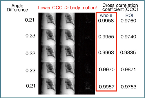 図10　投影画像の比較による体動および息止めの有無の確認
