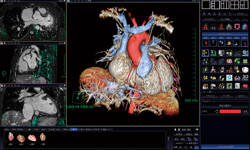 図4　3Dソフトウェアによる心･血管3D構築