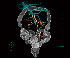 図7　CT angiography（仰臥位）