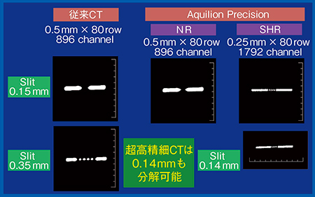 図1　Aquilion Precisionの最大空間分解能の検討