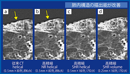 図4　従来CTとAquilion Precisionにおける撮影スライス厚の違いによる正常構造の画質比較
