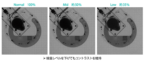 図5　Ultimax-iの透視線量モードにおける線量レベル別の画像比較
