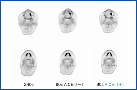 図17　頭頸部における撮像時間およびAiCE-iによる画像の変化