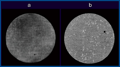 図1　0.75mmのマイクロスフィア画像 a：MDCT（512マトリックス） b：Aquilion Precision（1024マトリックス）