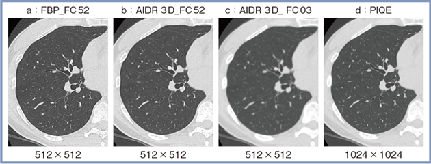 図1　ADCTによる胸部CT画像の比較（スライス厚：0.5mm）