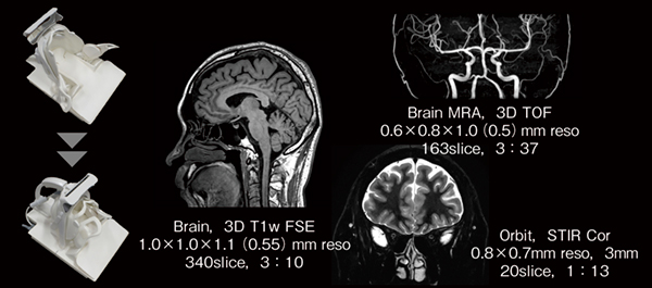 図1　FlexFit Neuroコイルで撮像したボランティア画像