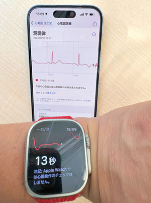 Apple Watchによる心電図モニタリング