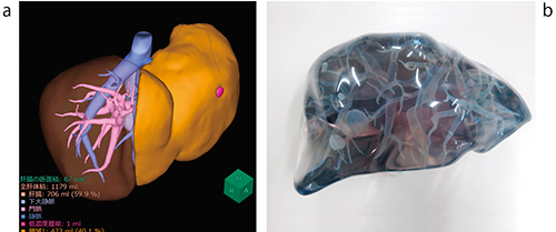 図1　肝臓3D模型の作製例