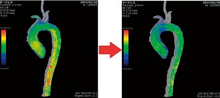 図3　4Dフローの解析画像