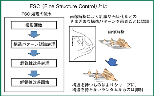 図2　微細構造鮮明化処理（FSC）