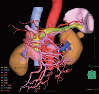 図2　膵臓解析にて作成した3D画像