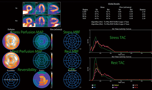 図6　4DMによる心臓定量解析結果画面