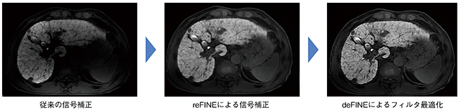 図2　体幹部画像クオリティの向上 （画像ご提供：Seoul National University Hospital様）