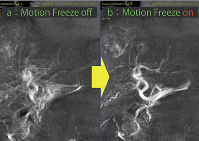 図1　Motion Freeze