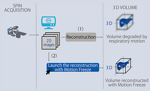 図2　Motion Freezeのワークフロー