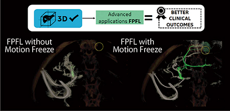 図6　Motion FreezeによりFPFLを活用できる画質に改善