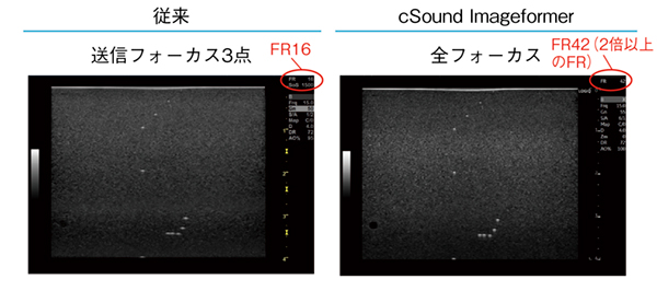 図2　cSound Imageformerの効果 cSound Imageformerにより高い空間分解能で深部まで明瞭に描出され，かつフレームレート（FR）も高い。