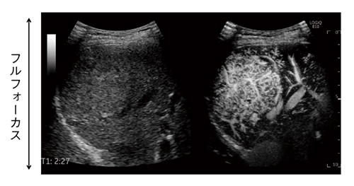 図3　フルフォーカス造影　画像全域において微細な血管構築が表現可能である。