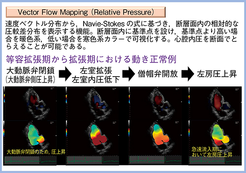 図3　VFMのRelative Pressureによるサクションの評価