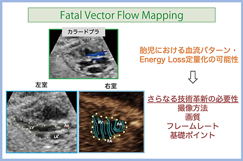 図3　胎児のVFMの可能性