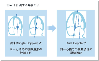 図1　‌E/e’を計測する場合のSingle Doppler法とDual Doppler法の比較