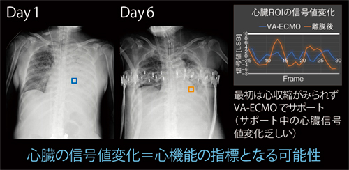 図2　症例2：肺炎による重症敗血症症例の心臓ROIの信号値変化