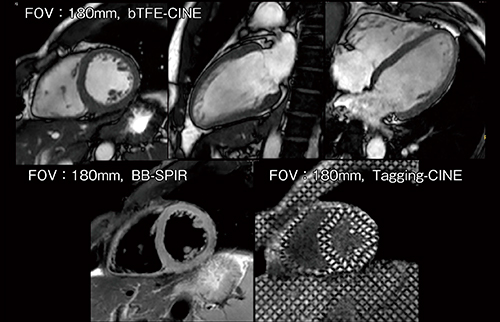 図5　Ingenia 3.0T CXによるdS Zoom Cardiac（FOV：180mm）