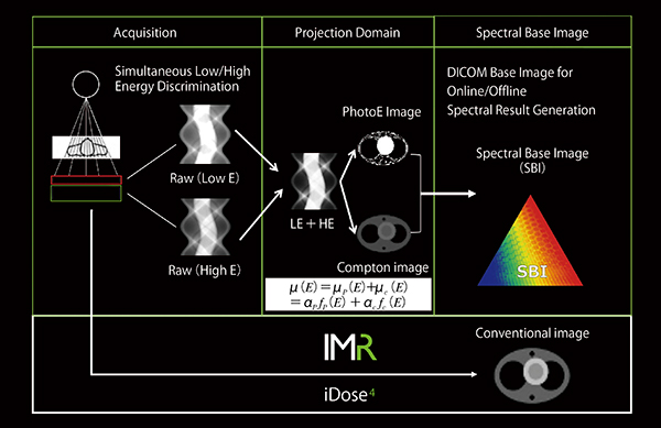 図1　IQonスペクトラルCTにおけるデータ取得から画像再構成までの概要