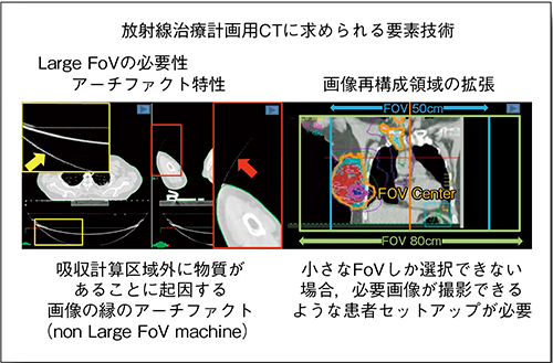 図2　Large FoV（HD FoV Pro）のメリット