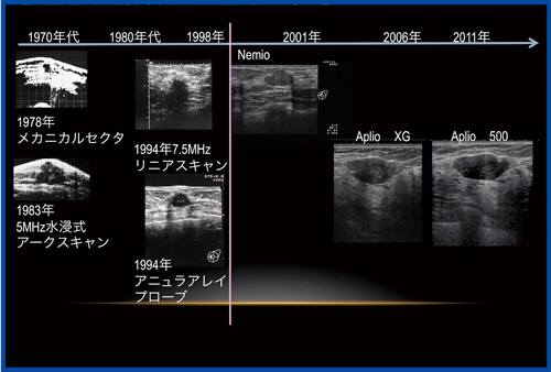 図2　乳腺超音波Bモード画像の変遷