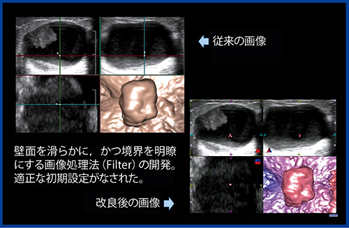 図6　フィルタの改善（適正な初期設定）：腫瘍