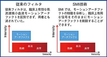 図2　SMIのキーテクノロジー