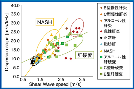 図7　臨床的検討におけるShear Wave speedとDispersion slopeの関係