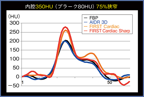 図2　350HUでのFBP，AIDR 3D，FIRST（Cardiac，Cardiac Sharp）のプロファイルカーブ