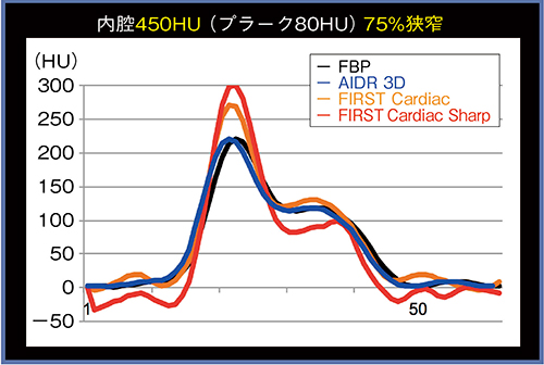 図3　450HUでのFBP，AIDR 3D，FIRST（Cardiac，Cardiac Sharp）のプロファイルカーブ