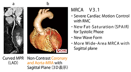 図2　新しいSPAIR法併用MRCA画像