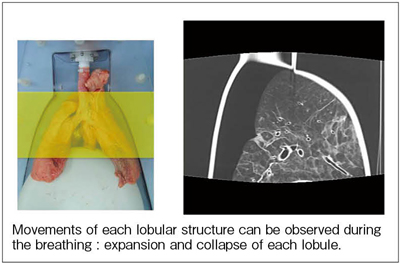 図3　ブタの生肺を用いた呼吸動態ファントムによる撮影