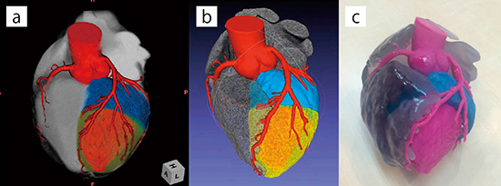 図1　Ziostation2で作製した心臓の3Dモデル