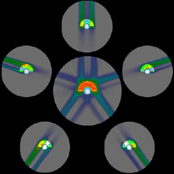 図3：回転ガントリーを使用した重粒子線治療の照射例