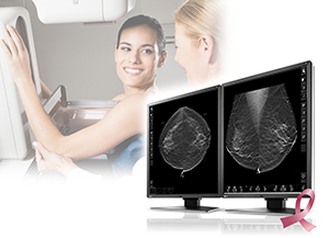 乳がん検査の画像表示に対応