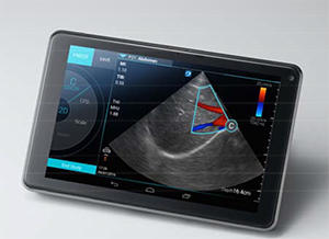 タブレット型超音波画像診断装置「SonoSite iViz」