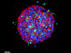 大腸がん患者から作成した細胞モデルの3次元解析結果 3次元細胞モデルに薬剤を投与。投薬後，死細胞が確認できる。（青:通常の細胞核，緑:死細胞）
