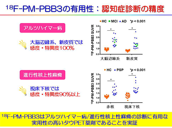 図4　18F-PM-PBB3はアルツハイマー病/進行性核上性麻痺を高い感度・特異度で健常者と区別可能 アルツハイマー病（AD），進行性核上性麻痺（PSP）のいずれにおいても18F-PM-PBB3の集積は健常者（HC，オレンジ）では疾患群（青：AD，緑：MCI（軽度認知機能障害）の値よりも低値であることが多数を占め，健常と疾患の区別が可能であることがわかる。