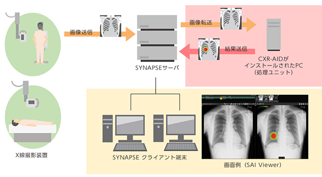 「胸部X線画像病変検出ソフトウェア CXR-AID」の構成例