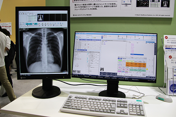 無床診療所向け画像ビューア一体型電子カルテシステム「Hi-SEED W3 EXV」