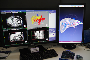3Dプリンタを用いた立体臓器モデル作成のソリューション