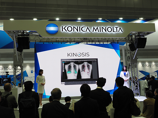 プレゼンテーションではX線動画解析ワークステーションの「KINOSIS」をPR