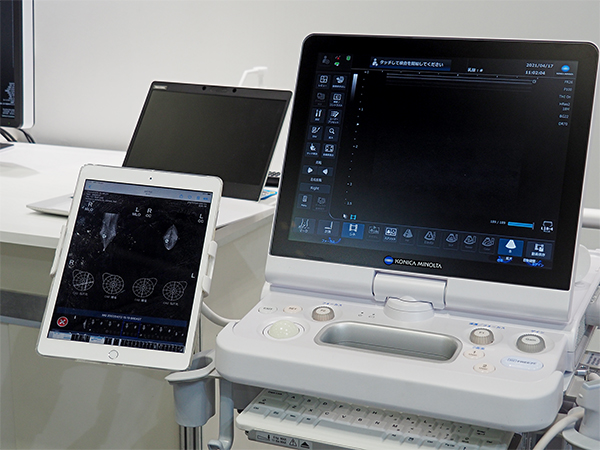 マンモグラフィ画像診断システム「FINO. VITA. PX type MG」。タブレットに表示されたエコーシェーマで病変位置を確認しながら超音波検査を行える